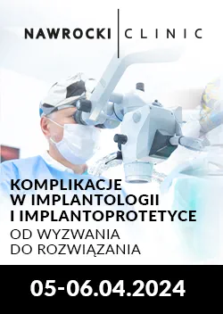Komplikacje w implantologii i implantoprotetyce – od wyzwania do rozwiązania