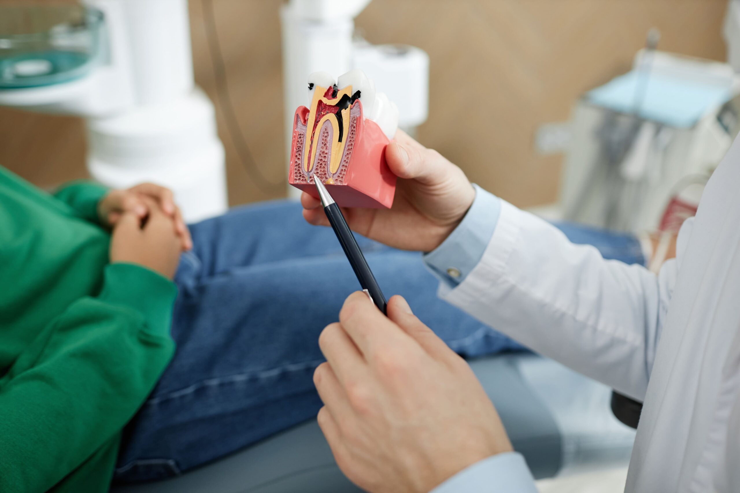 Zapalenie miazgi zęba – czym się objawia, jak leczyć?