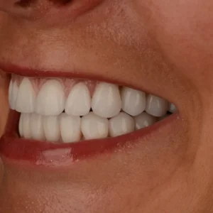dsc 6086