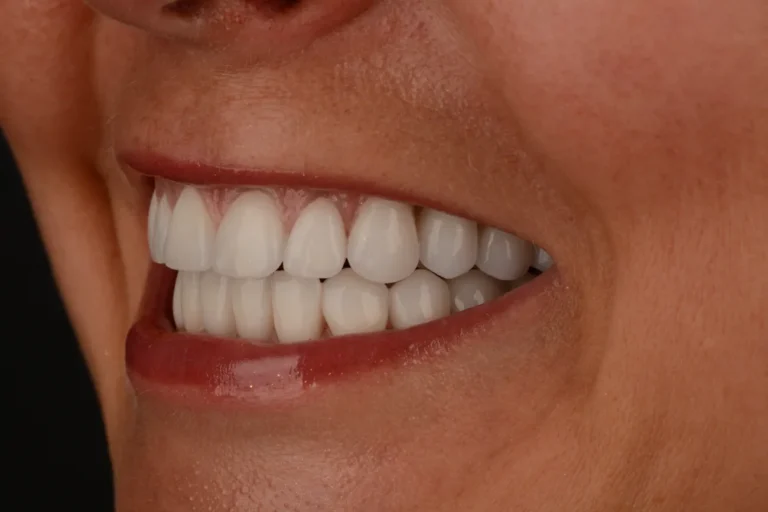 dsc 6086