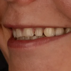 dsc 9244